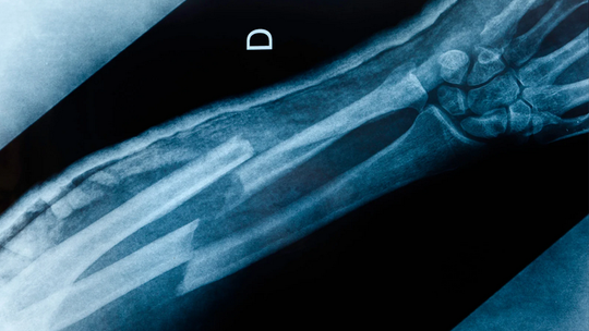 Idzie luty, podkuj buty. SOR w Słupsku pęka w szwach! Pacjentów przybywa