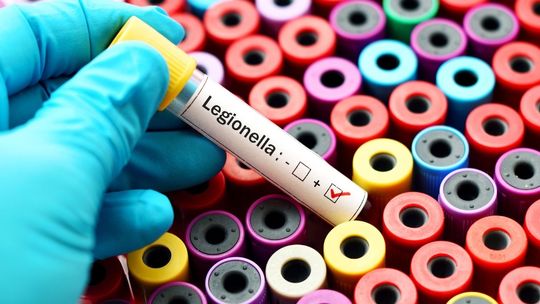 legionella