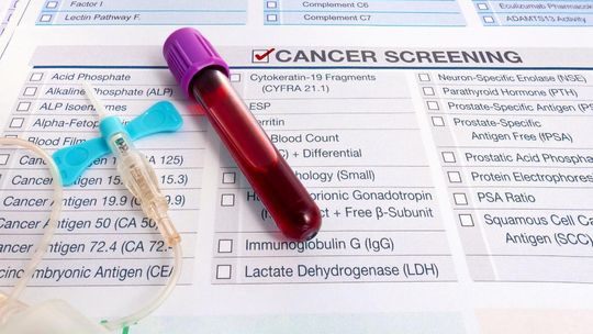 nowotwór, zdjęcie ilustracyjne