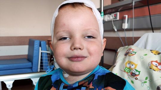 5-letni Nikodem z Czerska walczy o wzrok po operacji guza mózgu
