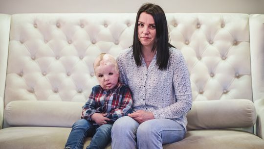 Światowej sławy chirurg wrócił do Gdańska. Pomoże Frankowi i innym poparzonym dzieciom