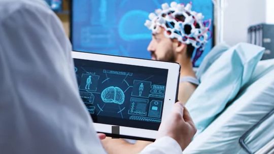 stymulacja mózgu, zdjęcie ilustracyjne