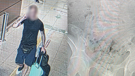 Gdańsk: W żołądku chciał przemycić kokainę. Połknął prawie 90 kapsułek