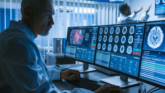 Wykryją tętniaka mózgu dzięki AI? Naukowcy z Gdańska pracują nad nową metodą