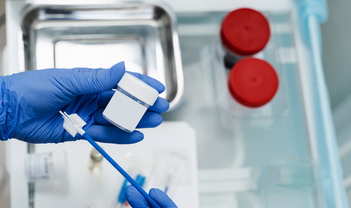 Koniec cytologii, jaką znały Polki. To badanie wykrywa raka znacznie wcześniej Koniec cytologii, jaką znały Polki. To badanie wykrywa raka znacznie wcześniej