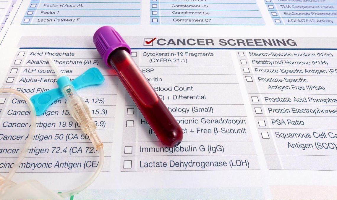 nowotwór, zdjęcie ilustracyjne