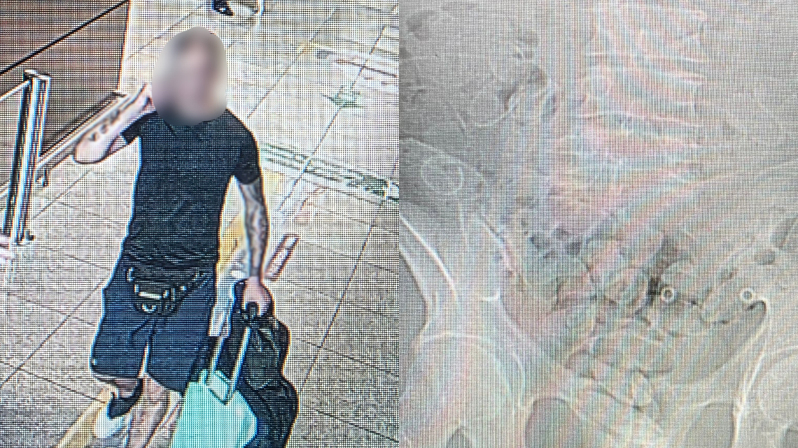 Gdańsk: W żołądku chciał przemycić kokainę. Połknął prawie 90 kapsułek