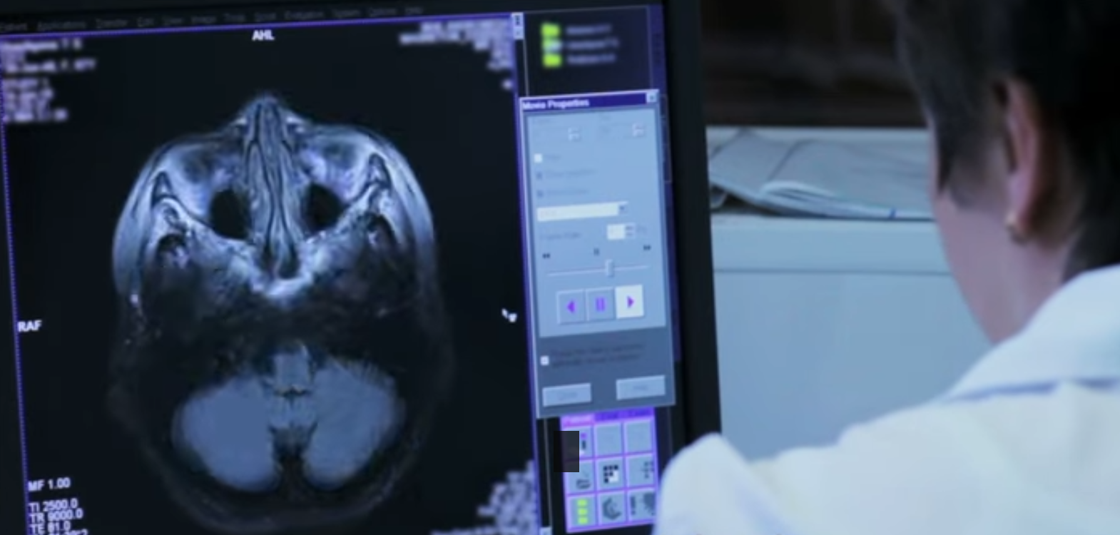 badania mózgu na Politechnice Gdańskiej